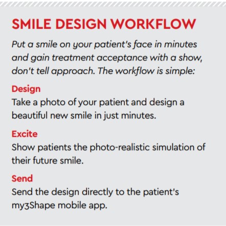 smile design workflow